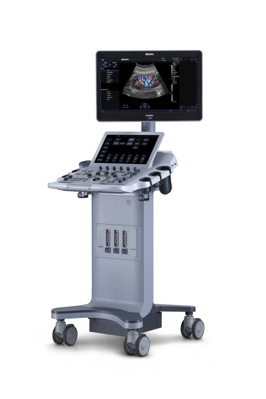 big ultrasound.jpg